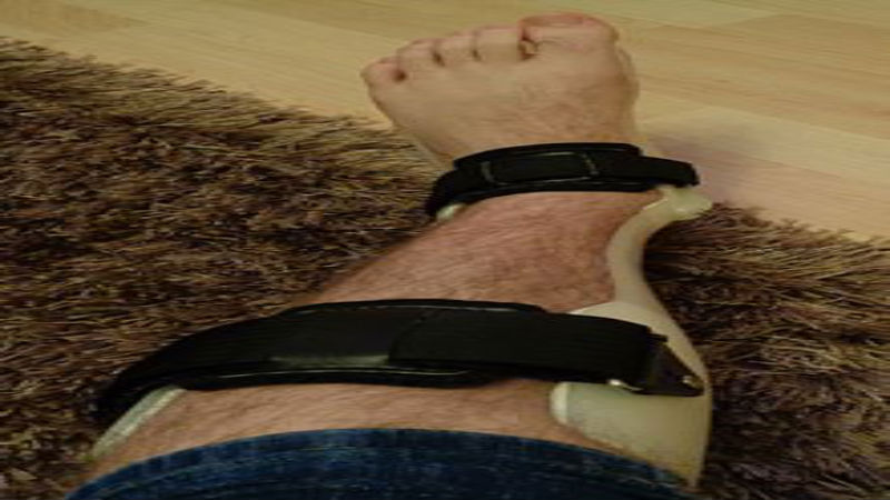 Why Foot Surgery should be a Last Option