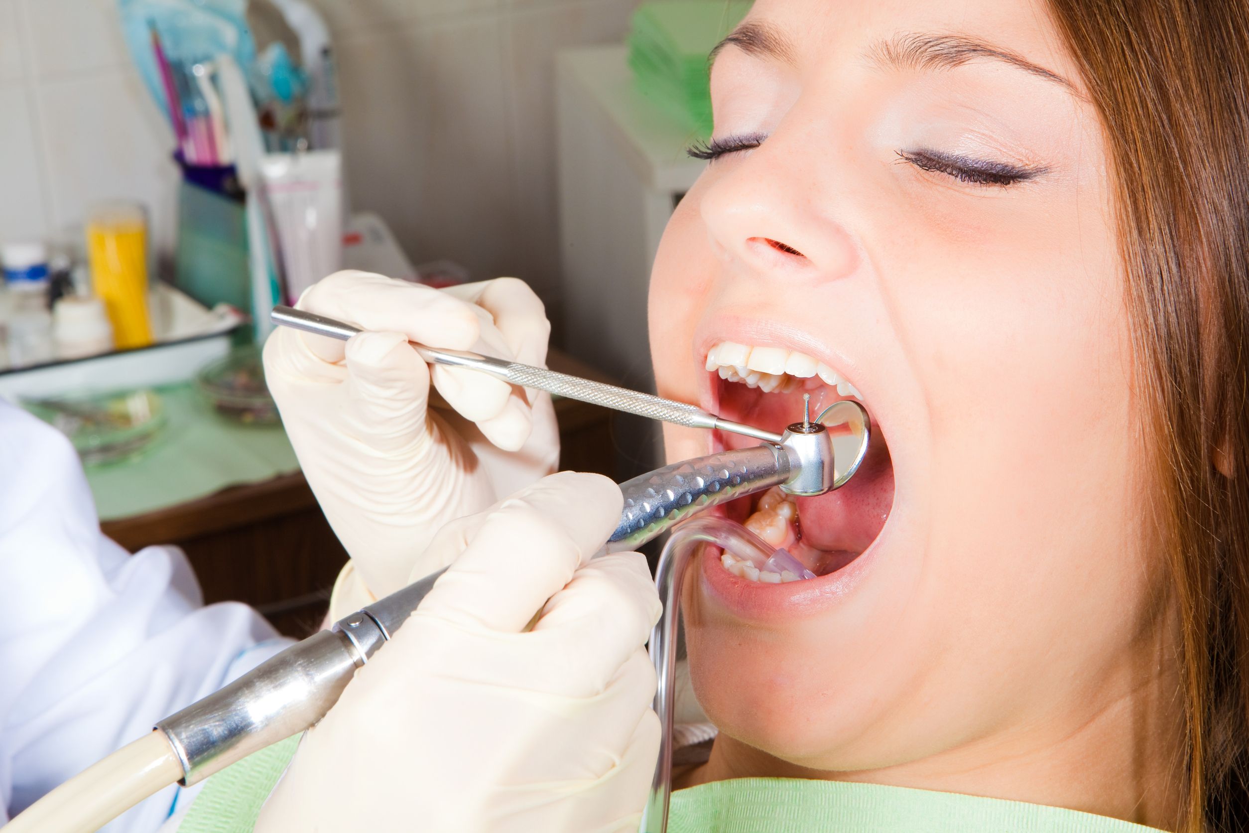 How Can You Prepare For Sedation Dentistry in Broken Arrow OK?