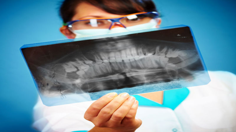 Cosmetic Dentistry: Creating The Perfect Smile