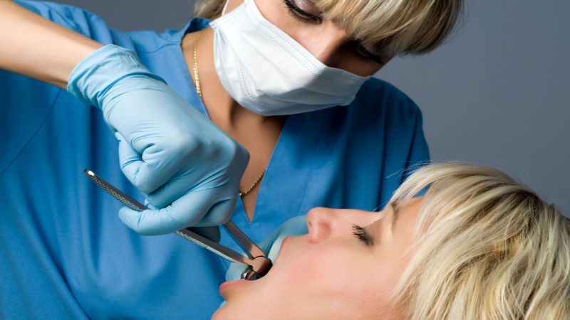 Root Canals: What You Need to Know