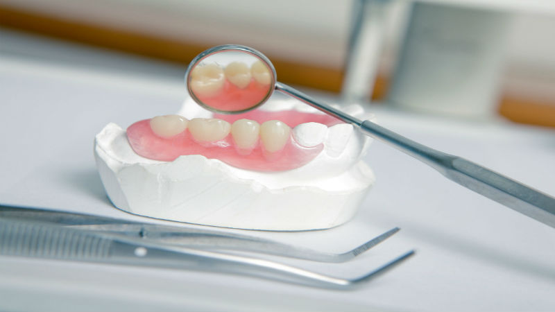 Benefits of Dental Crowns for Macon, GA Patients