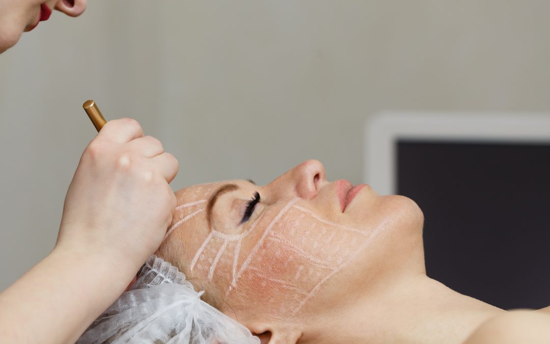 The Benefits of Choosing Laser Skin Rejuvenation in Jacksonville, FL for Healthier Looking Skin