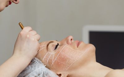 The Benefits of Choosing Laser Skin Rejuvenation in Jacksonville, FL for Healthier Looking Skin