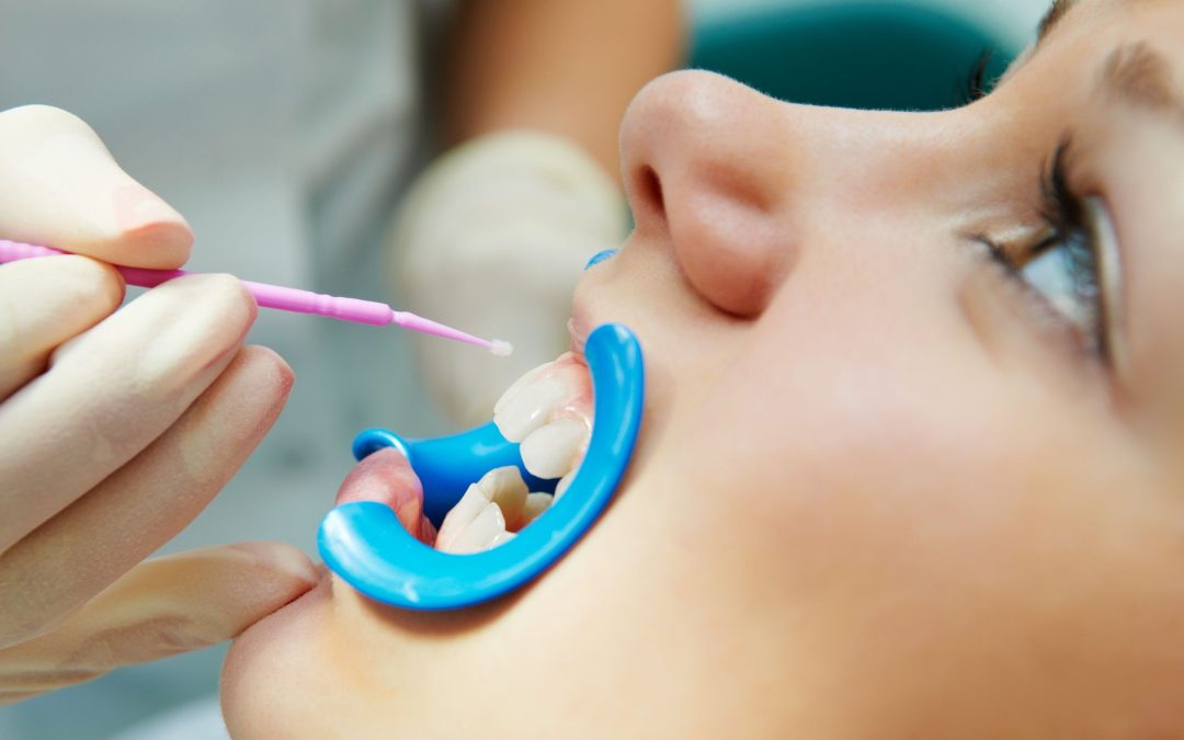 Get Family Friendly Care Near You with a Local Dentist in Parker, CO for Healthy Smiles