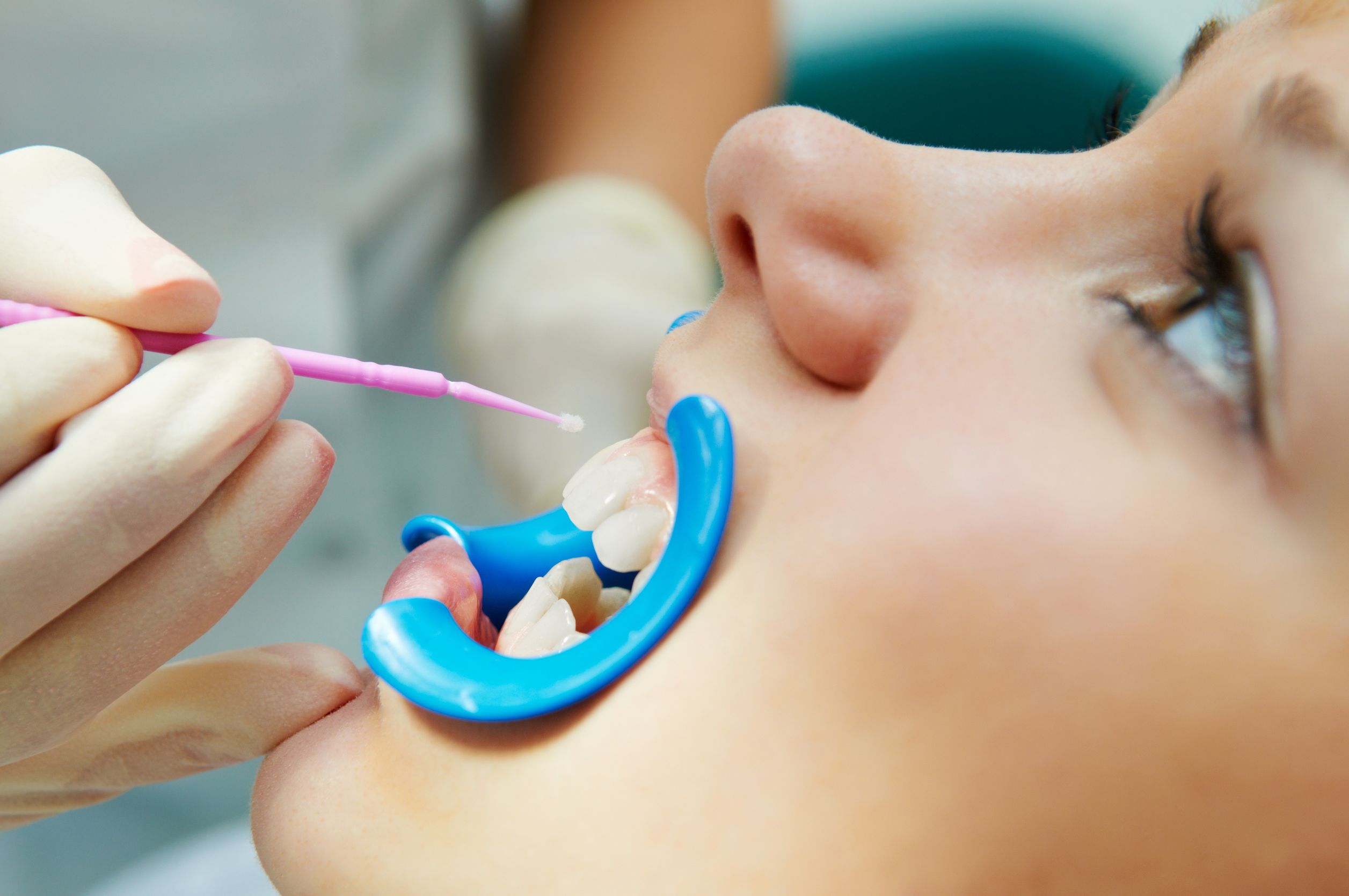 Experience Renewal Through Atlanta Cosmetic Dentists Focusing on Patient Comfort